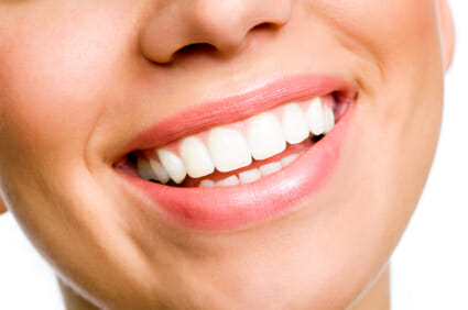 Teeth Straightening Systems